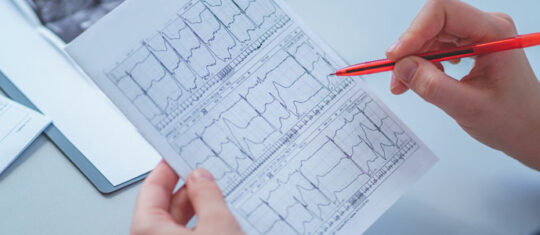 électrocardiogramme