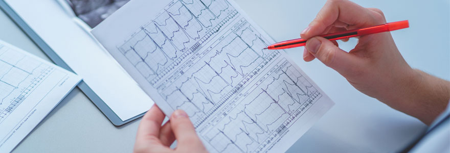 électrocardiogramme