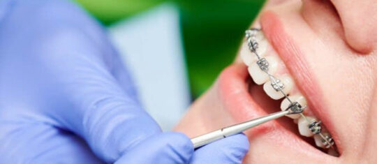 orthodontie